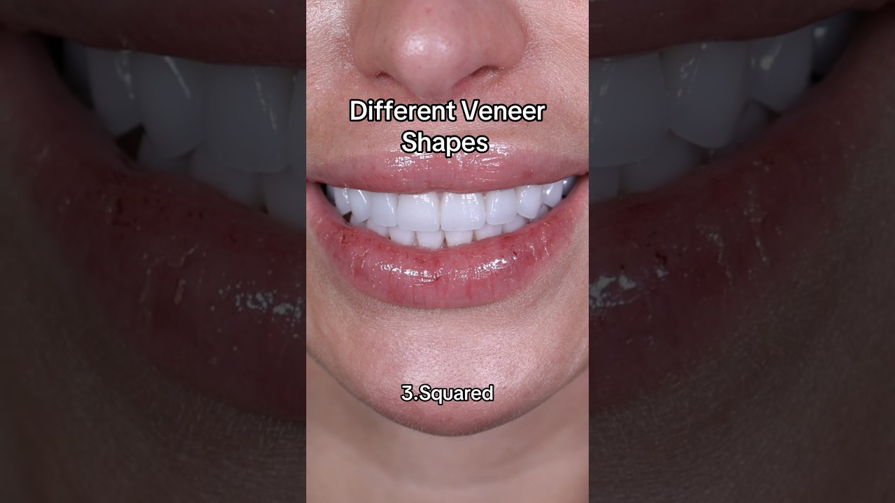 Different Veneer Shapes🦷Which shape are you choosing? #veneers #dentalveneers #veneershapes #teeth