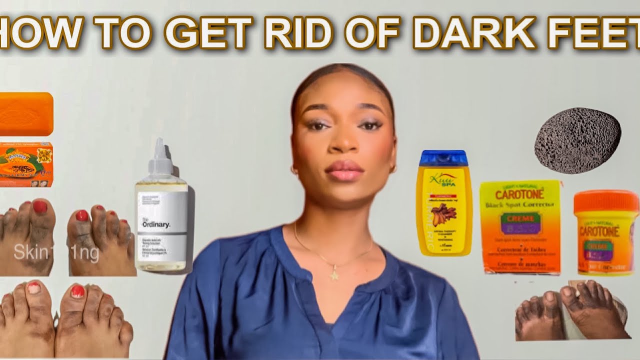 HOW TO GET RID OF DARK FEET. CAUSES | PREVENTIONS | TREATMENTS.