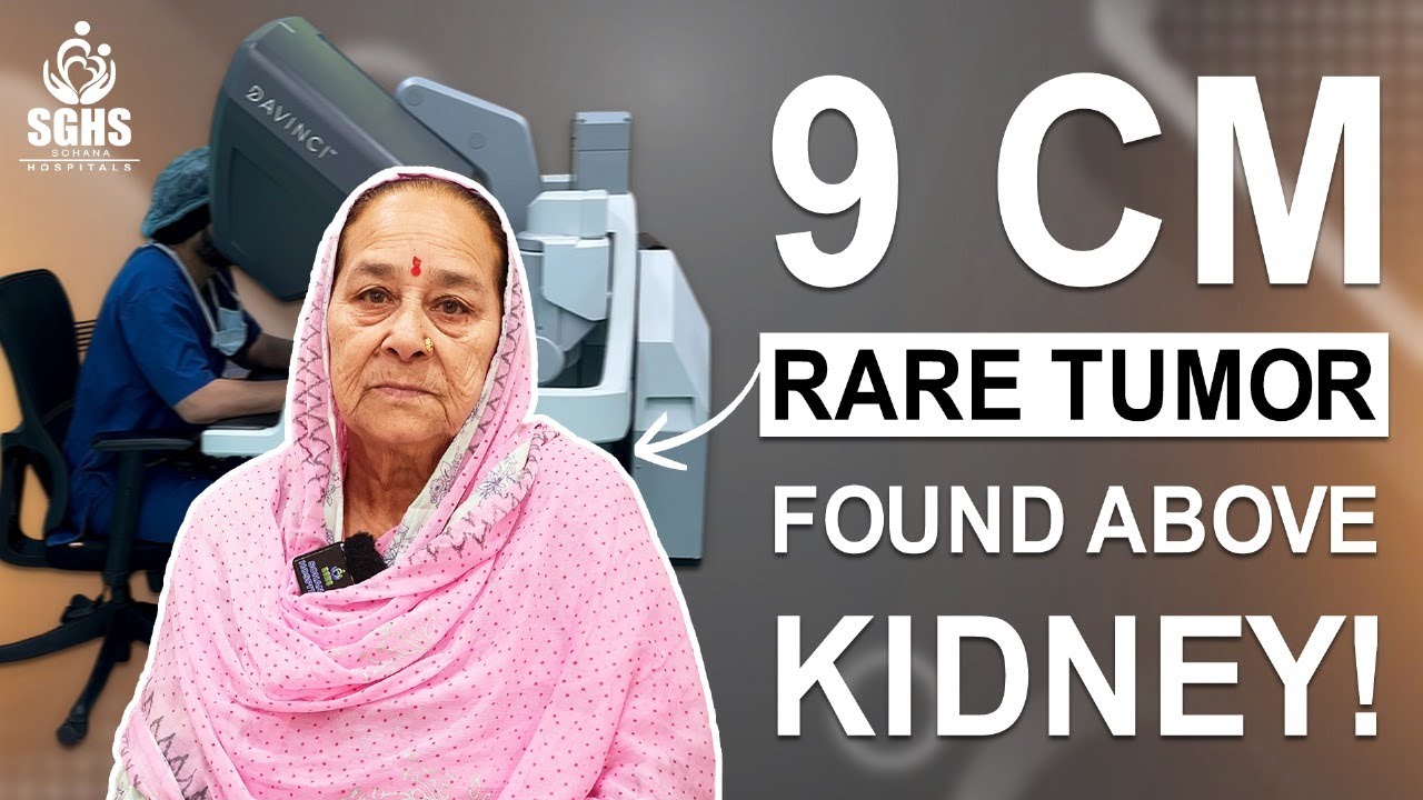 9 CM Rare Kidney Tumor | Robotic Nephrectomy for Kidney Cancer | Best Robotic Surgery in Chandigarh