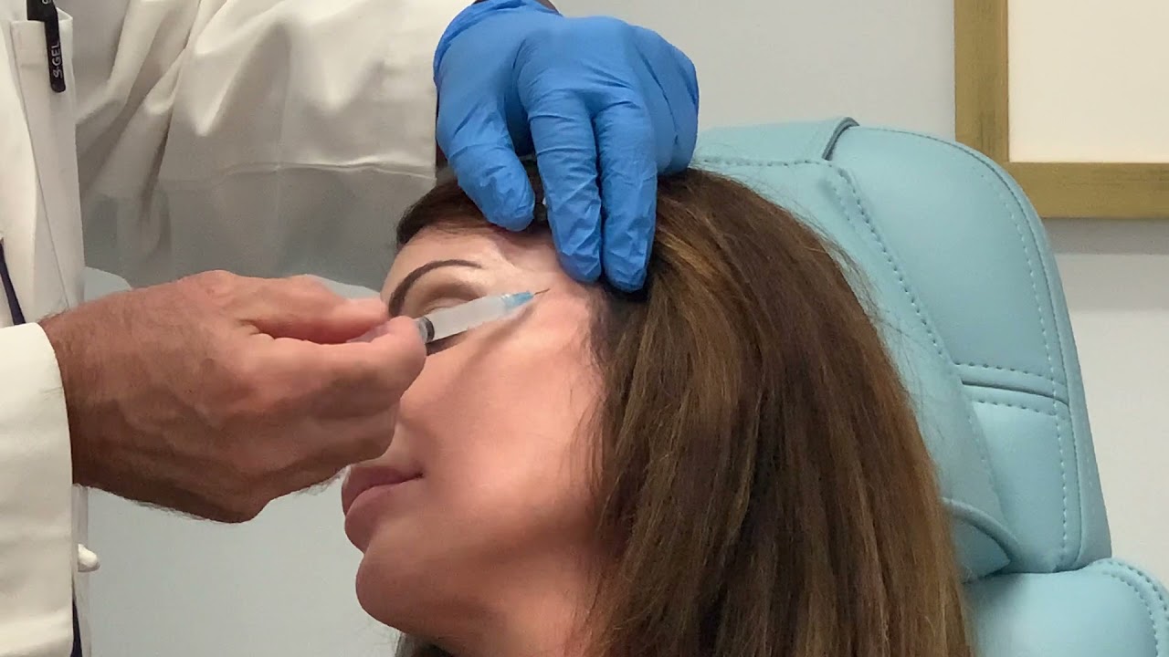Sculptra Injection into the Temporal Area