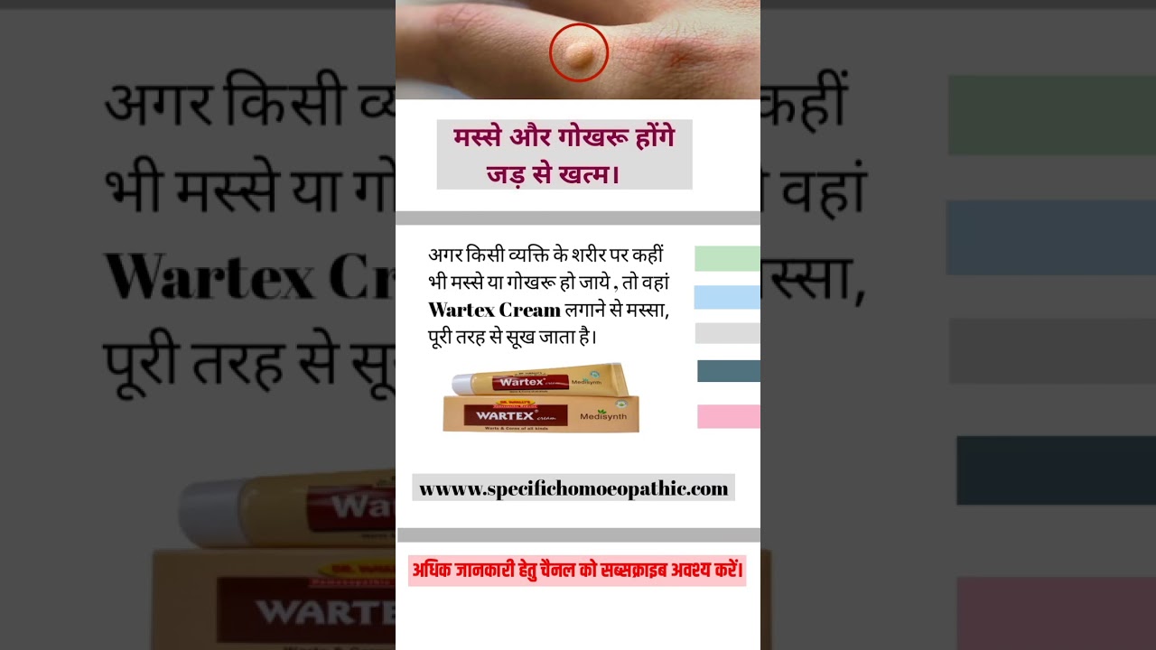 wartex cream homeopathic medicine/wartex cream #wartex homeopathic medicine #homeopathy #wartexcream