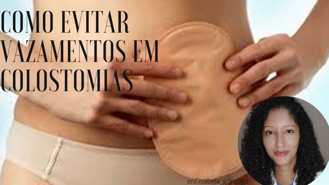 Como evitar vazamentos na colostomia: Dicas de enfermeira