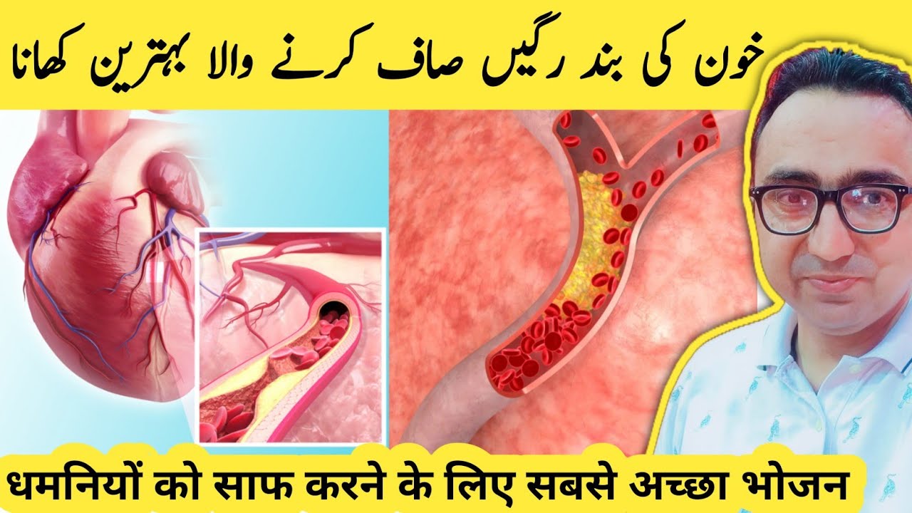 The Best MEAL To Clear Out Your Arteries - Dr Javaid Khan