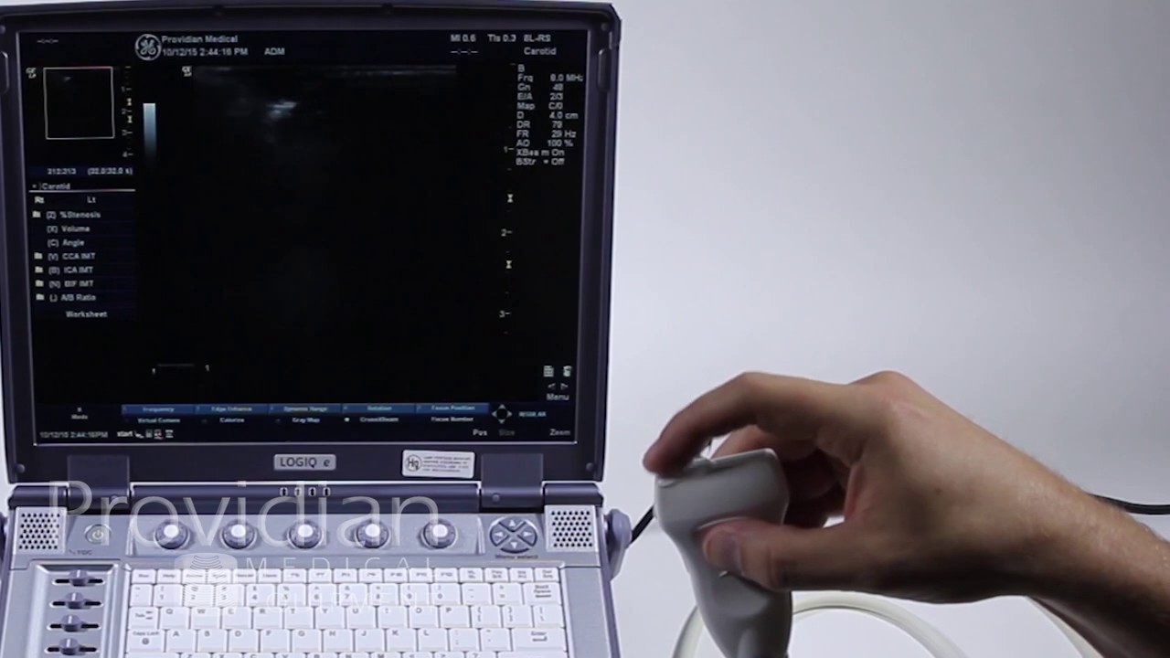 GE Logiq e Training Part 1: Getting Started