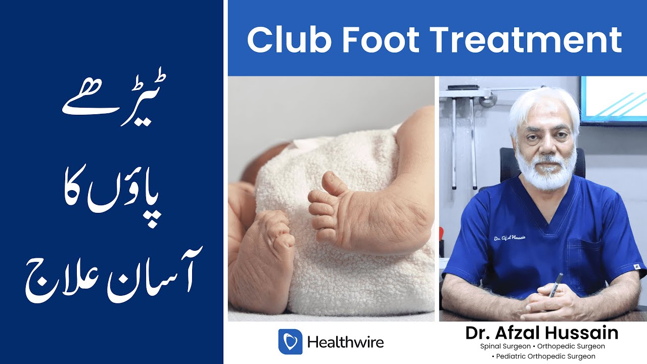 Club Foot - Bacho Ke Paidaishi Teray Paon Ka Ilaj In Urdu