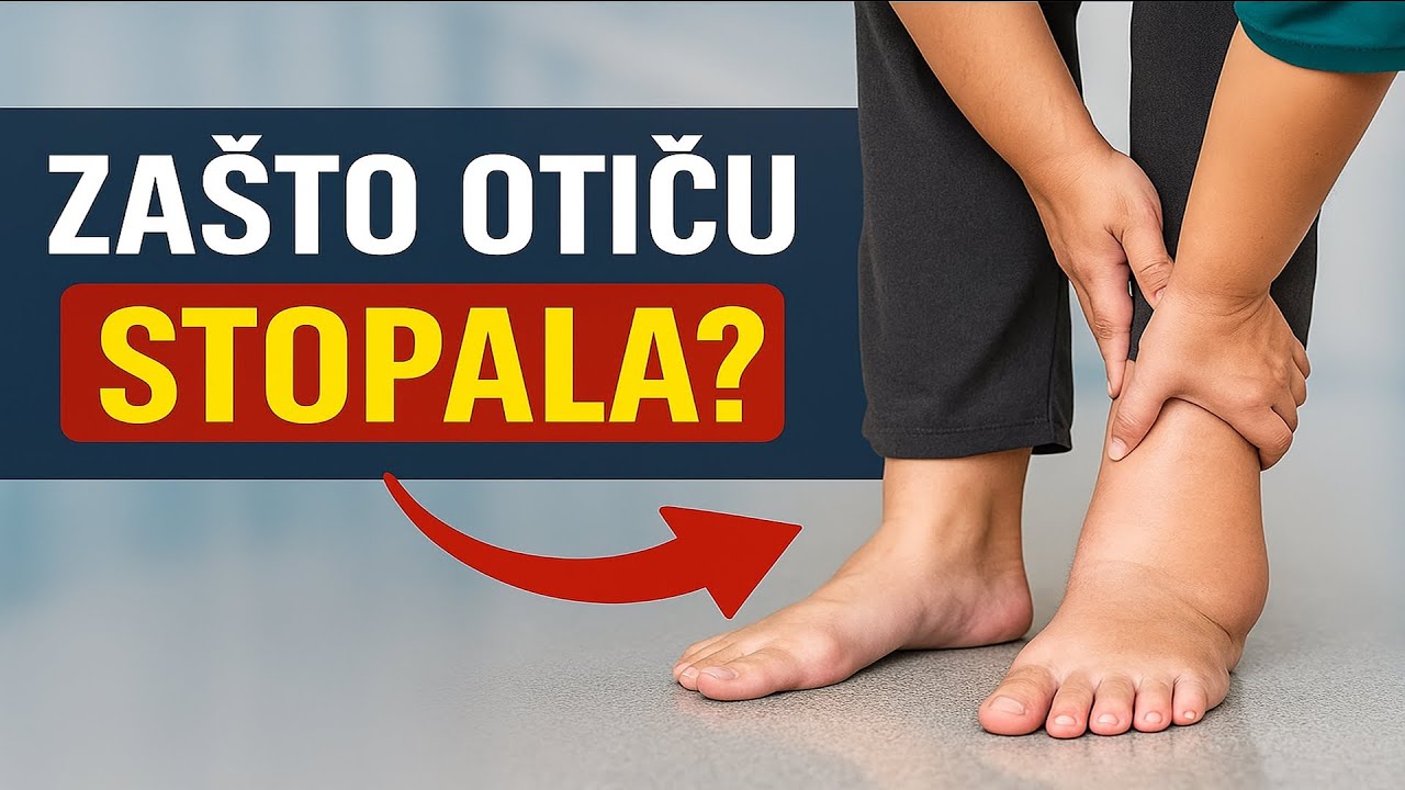 Oticanje nogu tokom ljeta - istina koju morate znati!