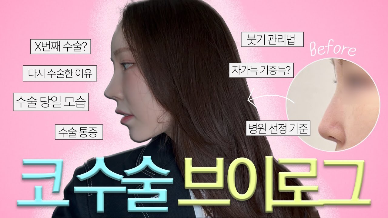 👃🏻 95년생 아들 딸 육아맘의 코수술 브이로그 / 역대급 마음에 드는 코수술 대장정 모두 보여드립니다🩵
