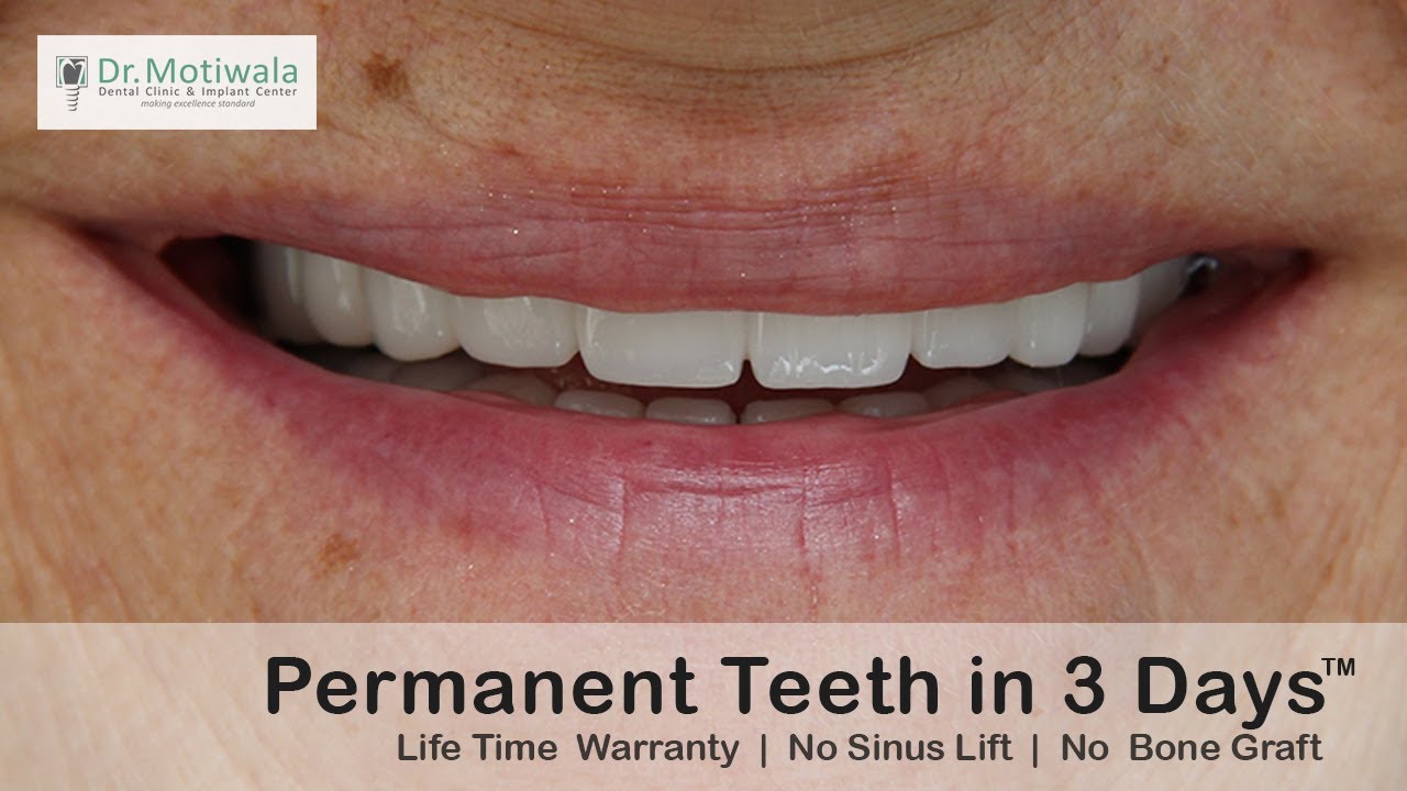 Florida, USA woman takes a drastic step of flying to India for  affordable full mouth dental implant