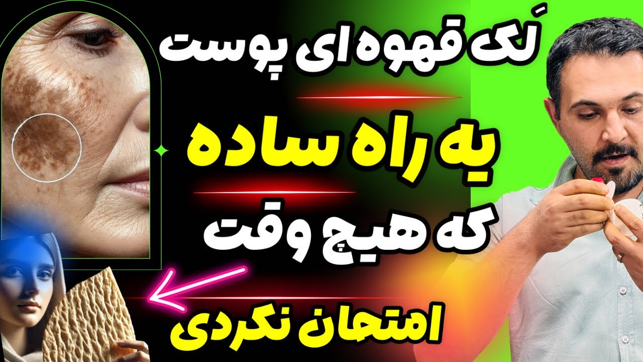 تو هنوز جوونی 😢 وقت داری| لک‌های قهوه‌ای آروم پوستت رو پیر و خسته نشون میدن | نذار کار به اینجا برسه