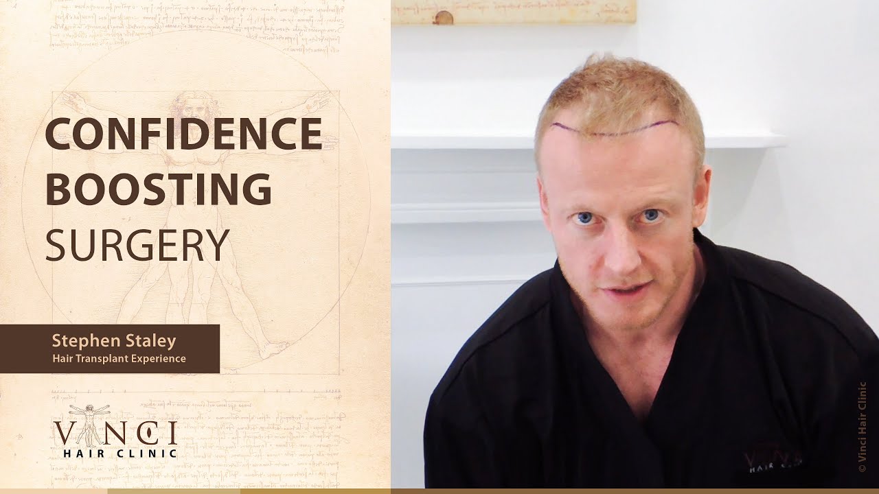 Stephen Staley Hair Transplant Experience - Confidence boosting surgery