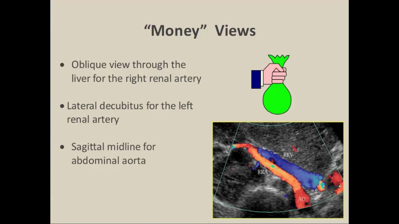 Renal Doppler Ultrasound (Basics)