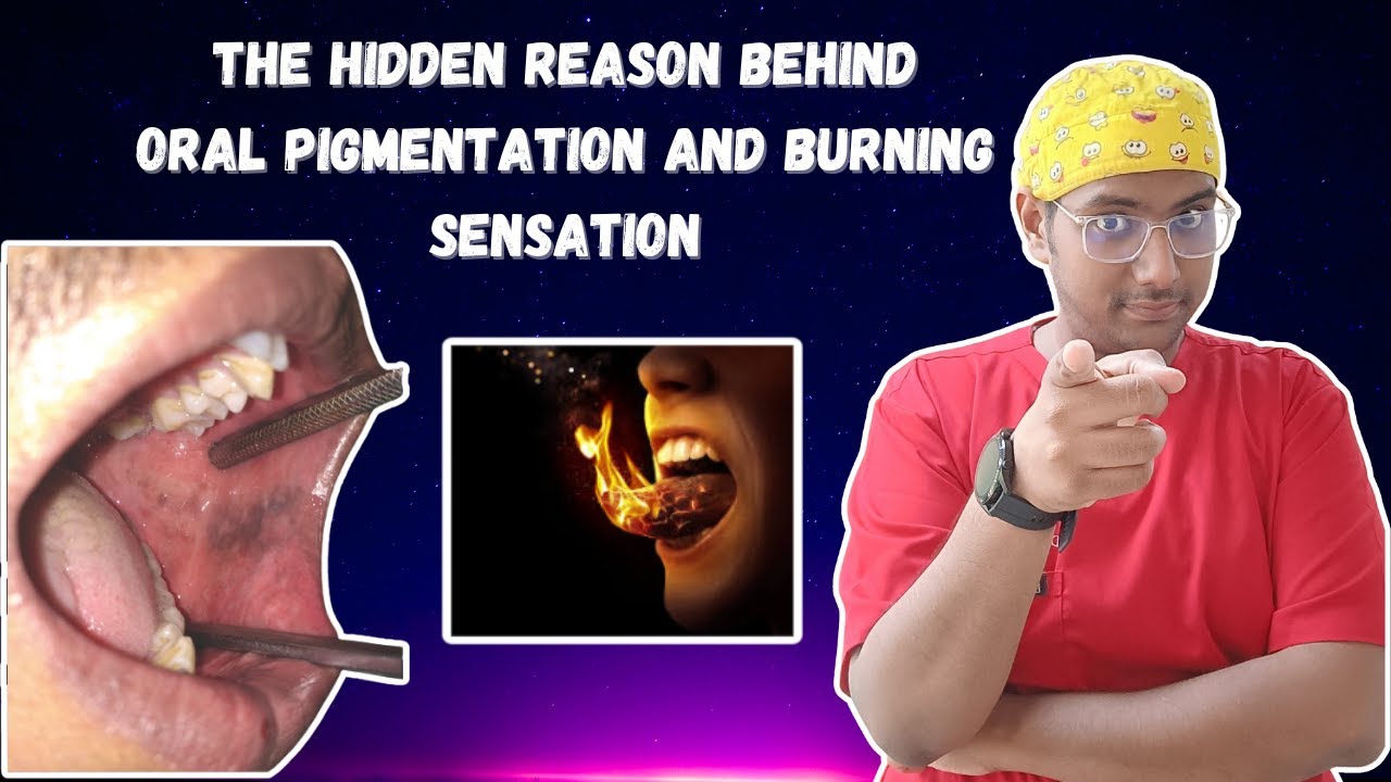 Dr Rudra Mohan |The Hidden Reason Behind Oral Melanin Pigmentation & Burning Sensation in the Mouth