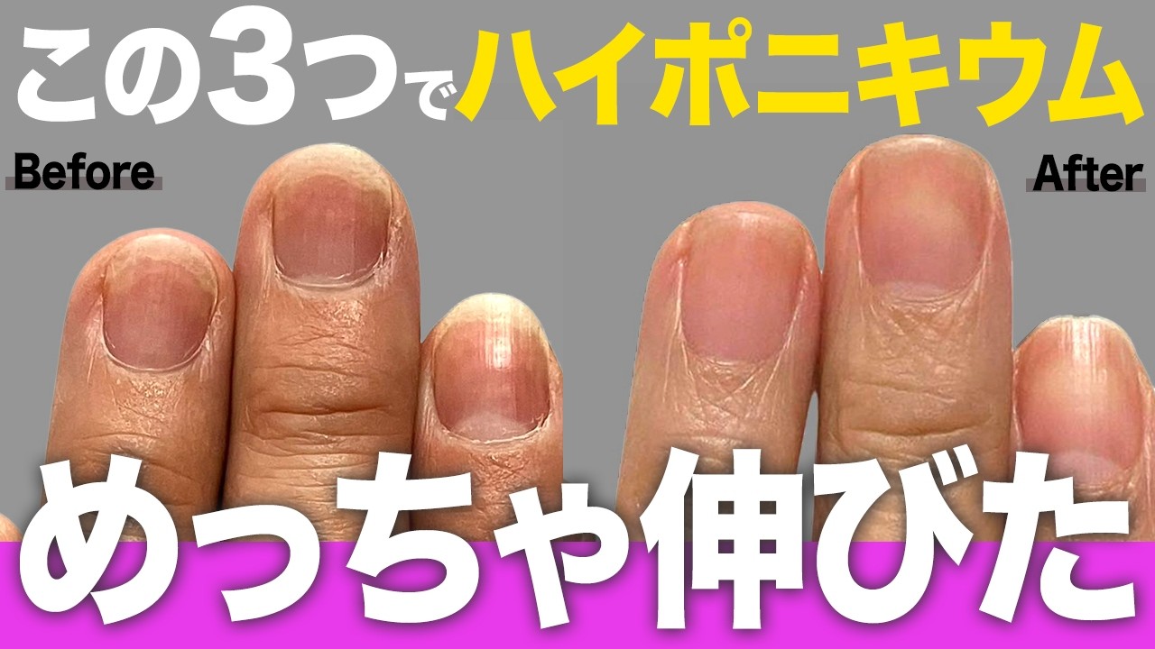この３つでハイポニキウムめちゃくちゃ伸びた💅【爪のピンク部分】