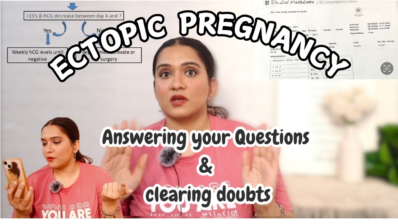 ECTOPIC PREGNANCY - Answering Questions & Doubts | Replying to your comments 💟
