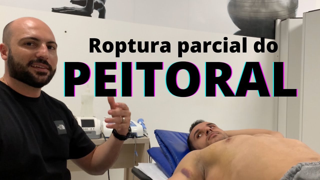 Lesão de peitoral, e agora o que fazer ? #musculacao #fisiculturismo #peitoral
