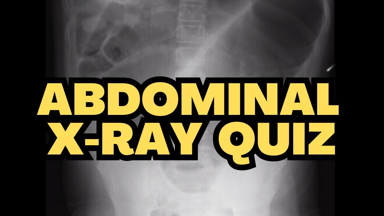Abdominal X-ray Quiz