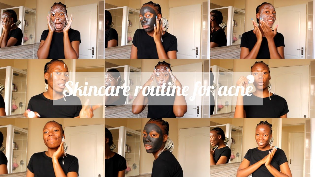 LIVING WITH ACNE • SKINCARE ROUTINE FOR ACNE • BIONIKE • South African YouTuber