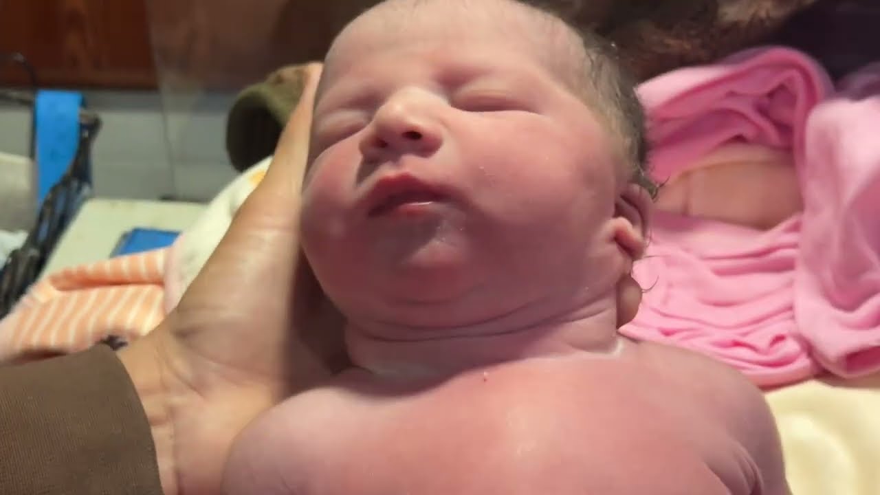 Newborn Baby Diaper Change & First Care in NICU | Newborn Care Education 👶🩺