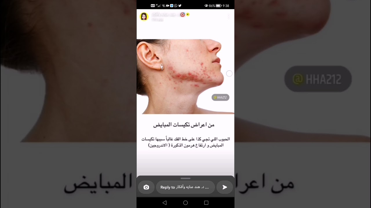 متلازمة تكيس المبيض، أسبابها والحلول الفعالة (سناب دكتوره هند)