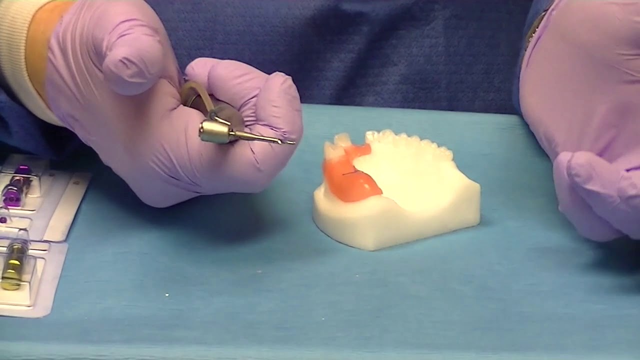 Dr. Timothy Kosinski - Immediate Implant Placement After Extraction: Hands-on Program