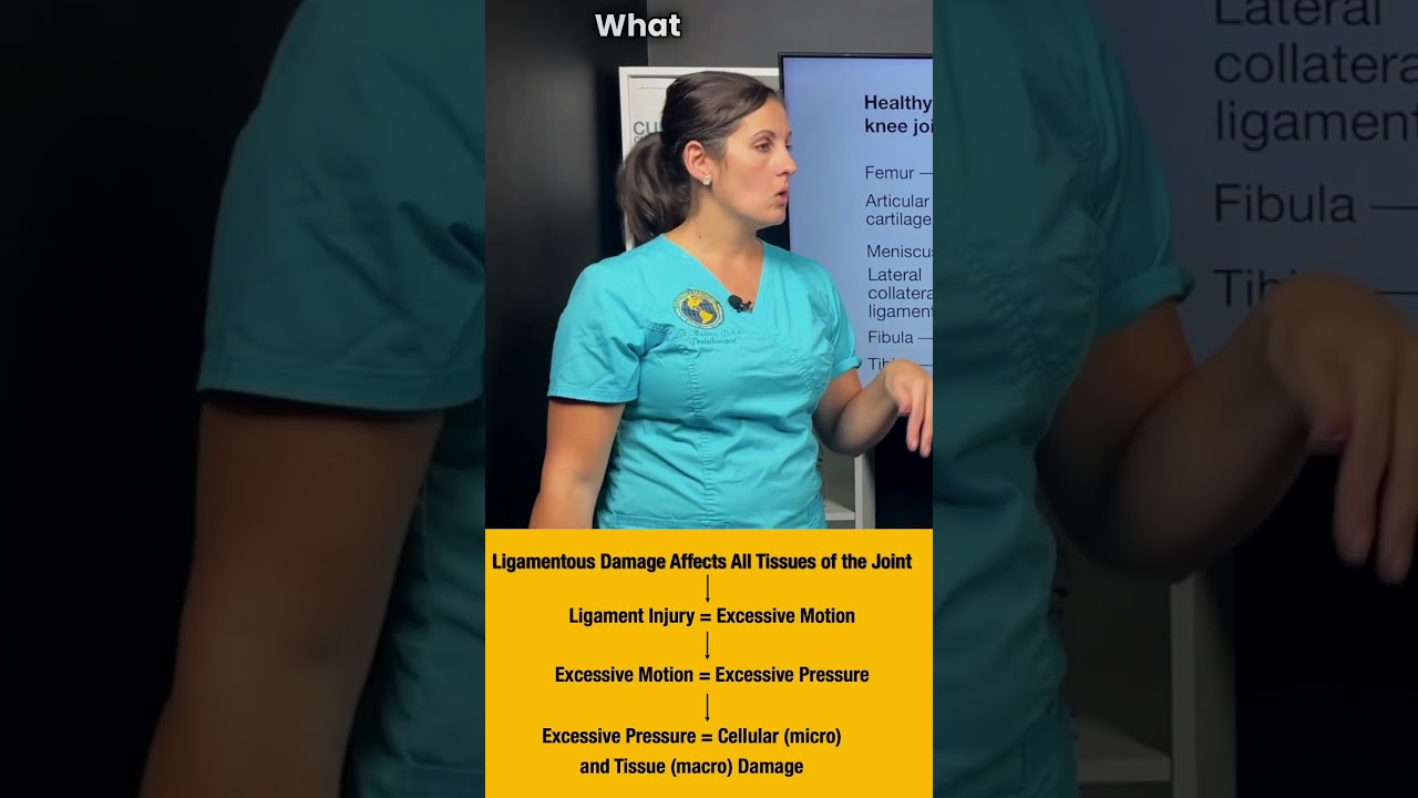 Knee instability from ligament damage #prolotherapy #meniscustear #MCL #ACL #LCL #osteoarthritis