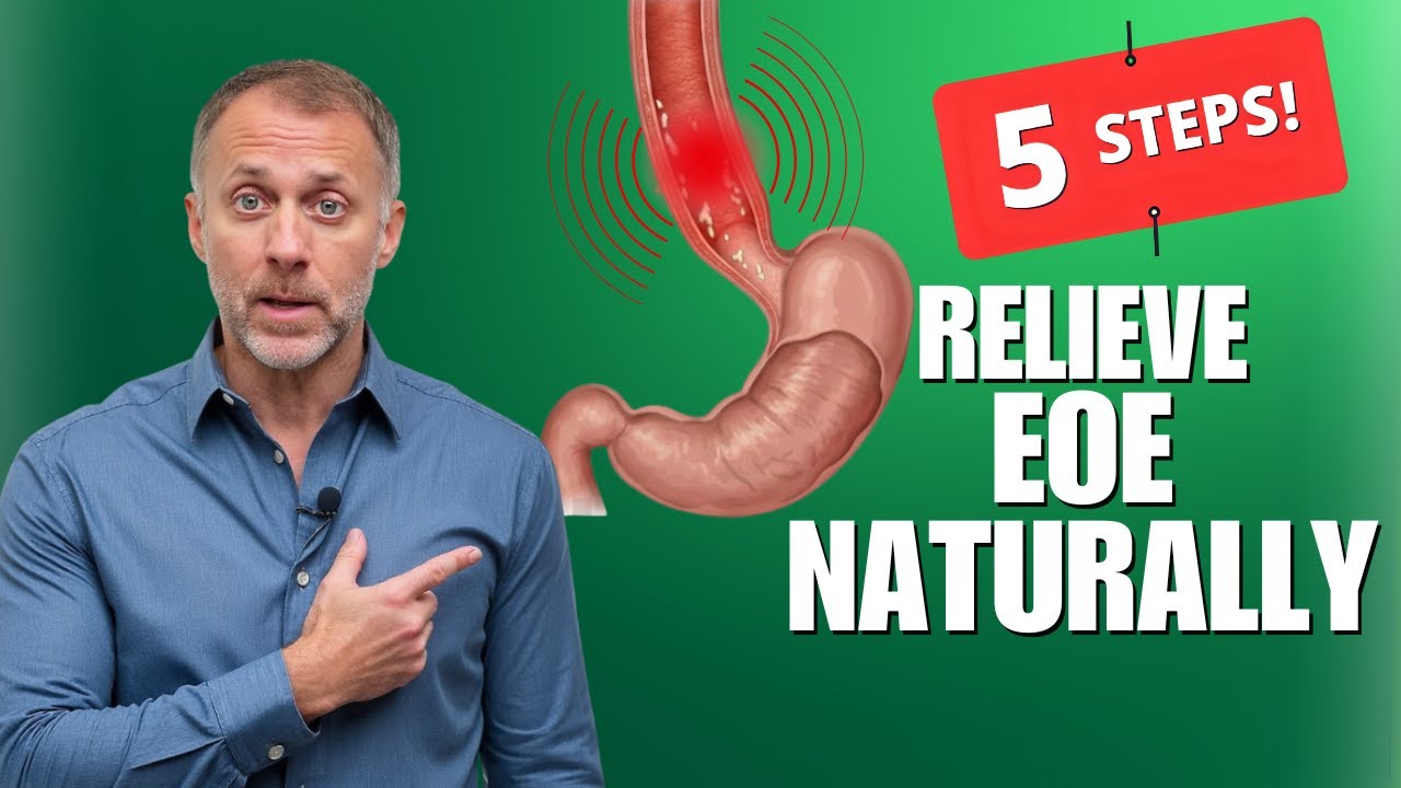 5 Ways to Relieve Eosinophilic Esophagitis Naturally