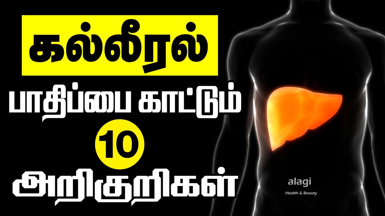 கல்லீரல் பாதிப்பின் அறிகுறிகள் | 10 Early Signs of Liver Damage Tamil | symptoms of liver problems