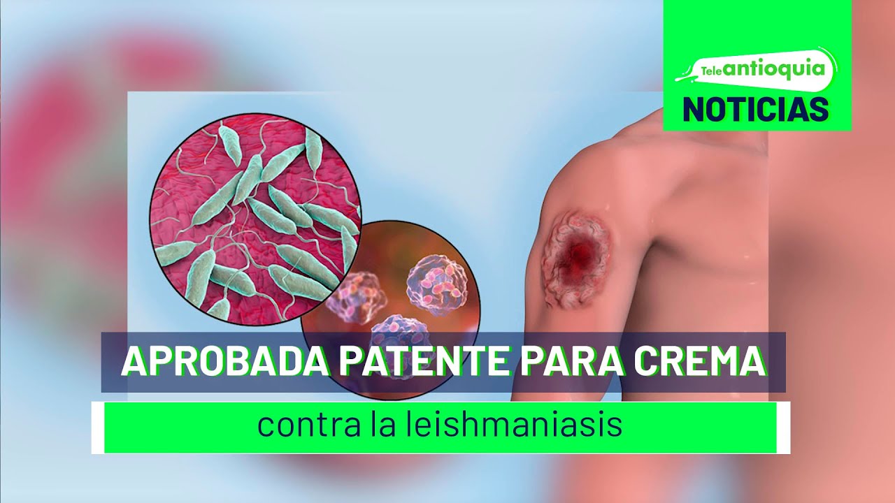 Aprobada patente para crema contra la leishmaniasis - Teleantioquia Noticias