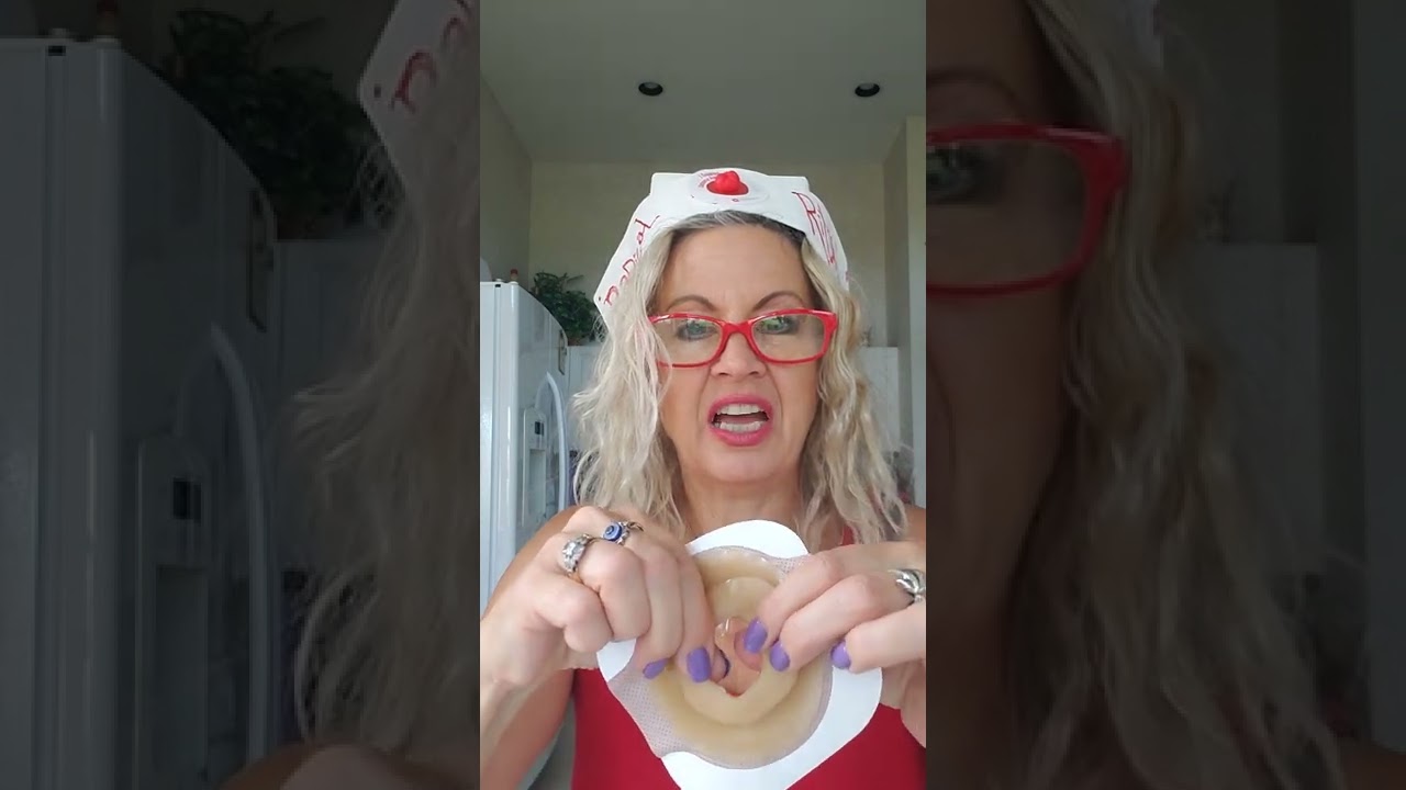 Ostomy Barrier Rings