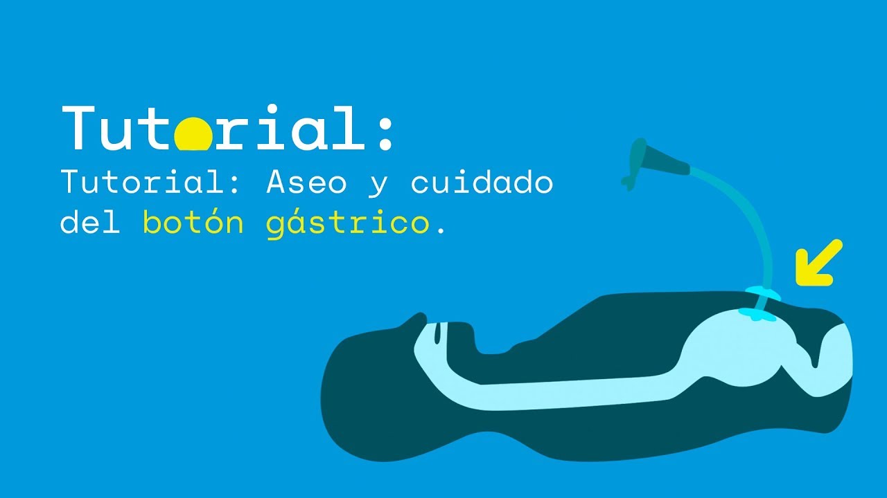 Tutorial: Aseo y cuidado  del botón gástrico.