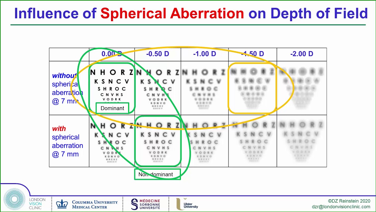 Treatment of Presbyopia (reading vision) by LASIK - Professor Dan Reinstein American Academy Lecture