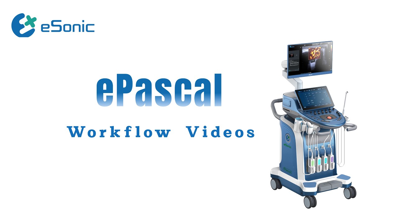 Workflow Video of ePascal