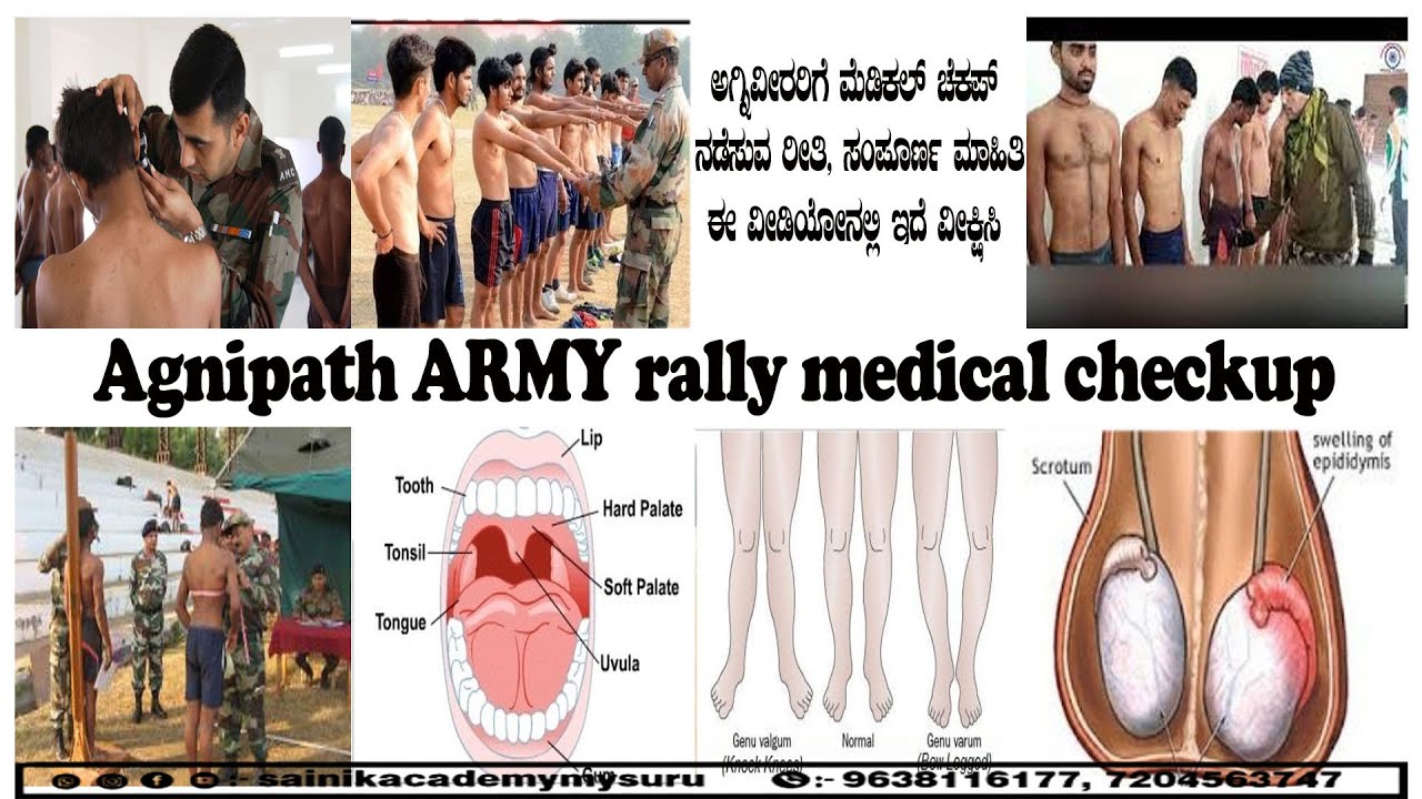 Agnipath  ARMY  RALLY  medical checkup l  ಸಂಪೂರ್ಣ ಮಾಹಿತಿ ಈ ವೀಡಿಯೋ ನಲ್ಲಿ ಇದೆ ವೀಕ್ಷಿಸಿ👨🏻‍✈️🧑🏻‍✈️🇮🇳 🇮🇳