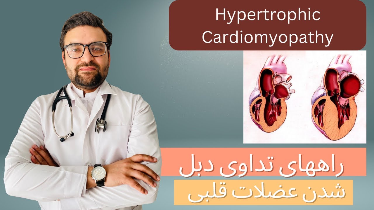 Dotor Waheed | Hypertrophic Cardiomyopathy | HCM |راههای تداوی | دبل یا ضخاموی شدن عضلات قلبی