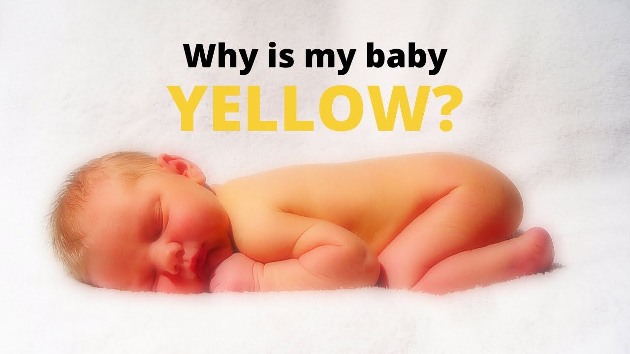 Jaundice - Timing, Causes, Treatment & Needed Follow-up. Why is my baby YELLOW?