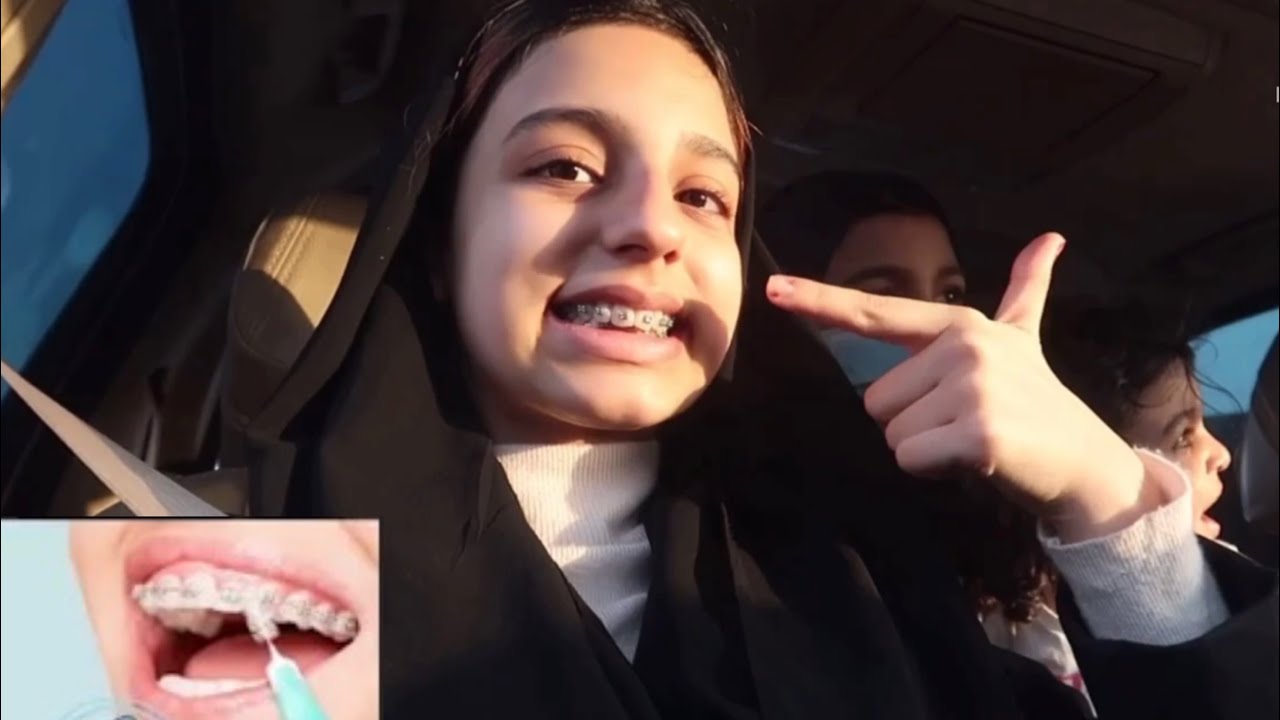تقويم أسنان + جاوبنا ع أسئلتكم