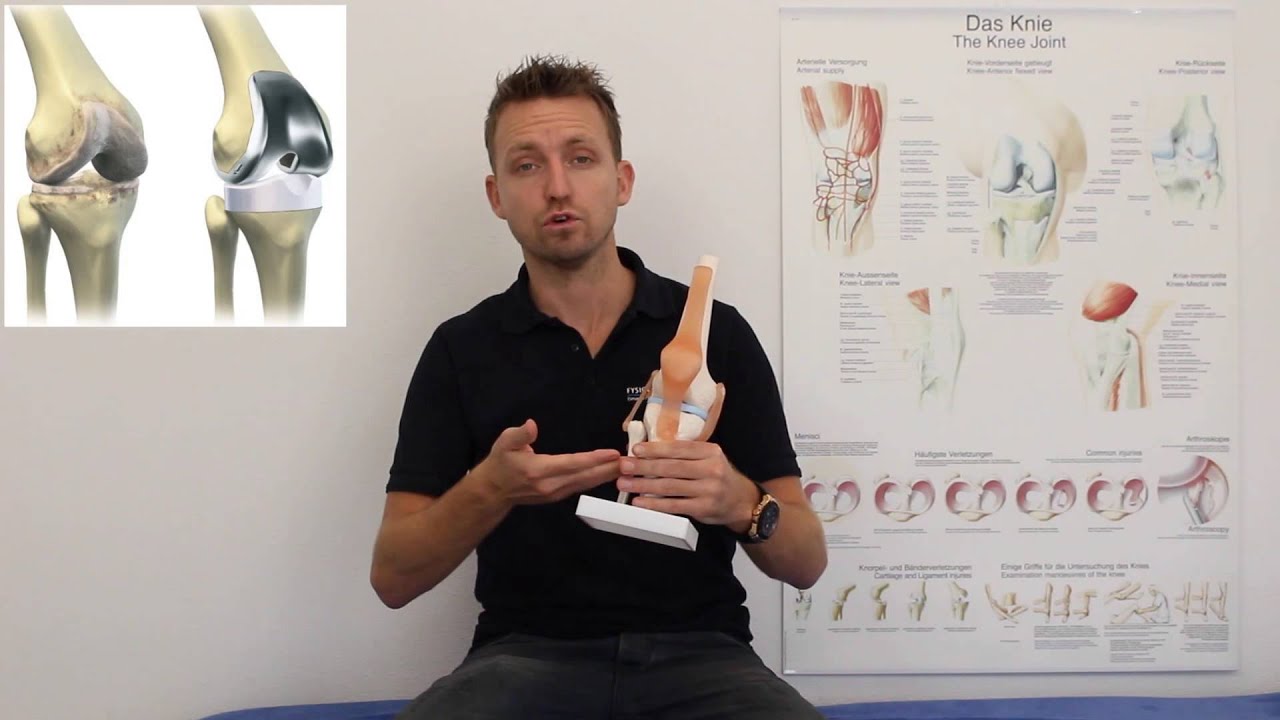 Nieuwe knie prothese - Fysiotherapie4all