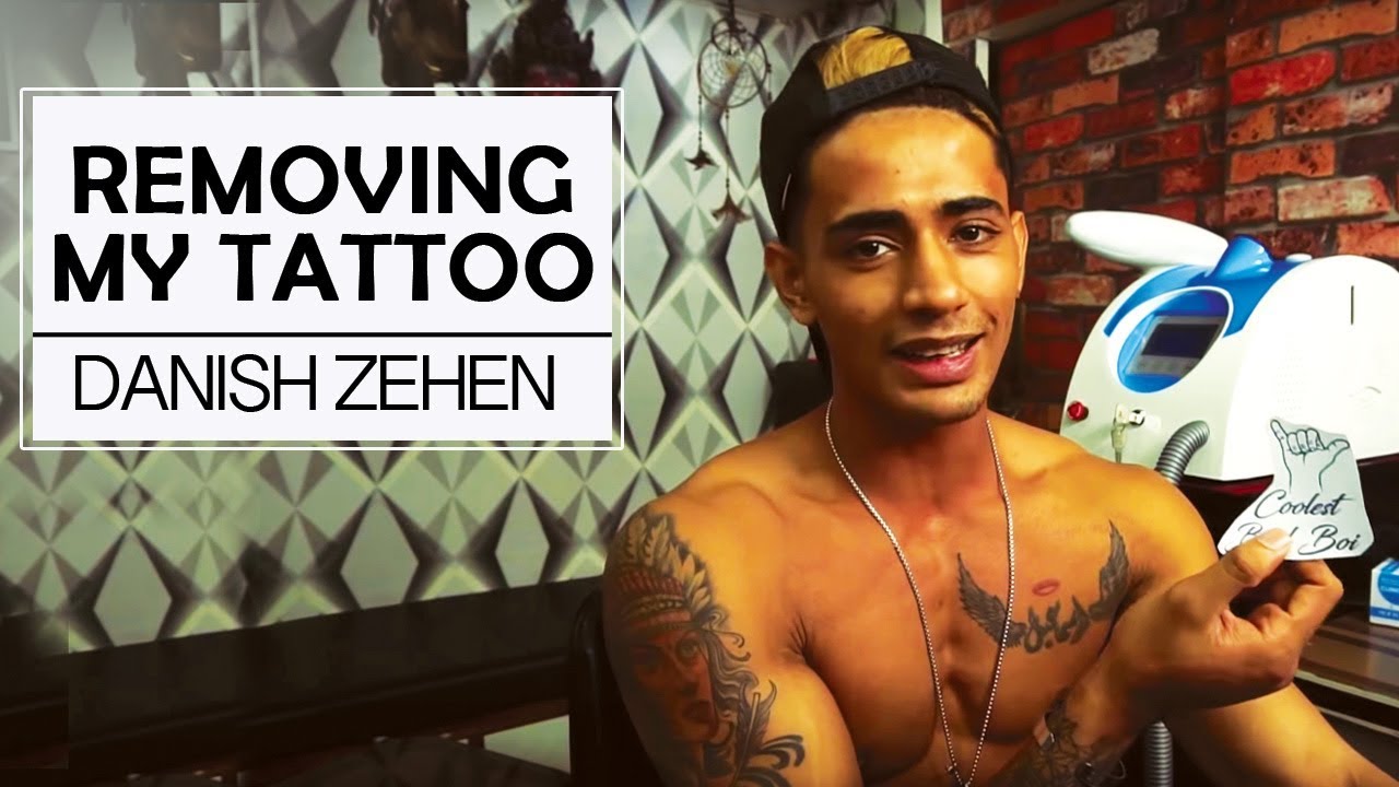 Removing My Hand Tattoo - Why Did I Do It? | Danish Zehen
