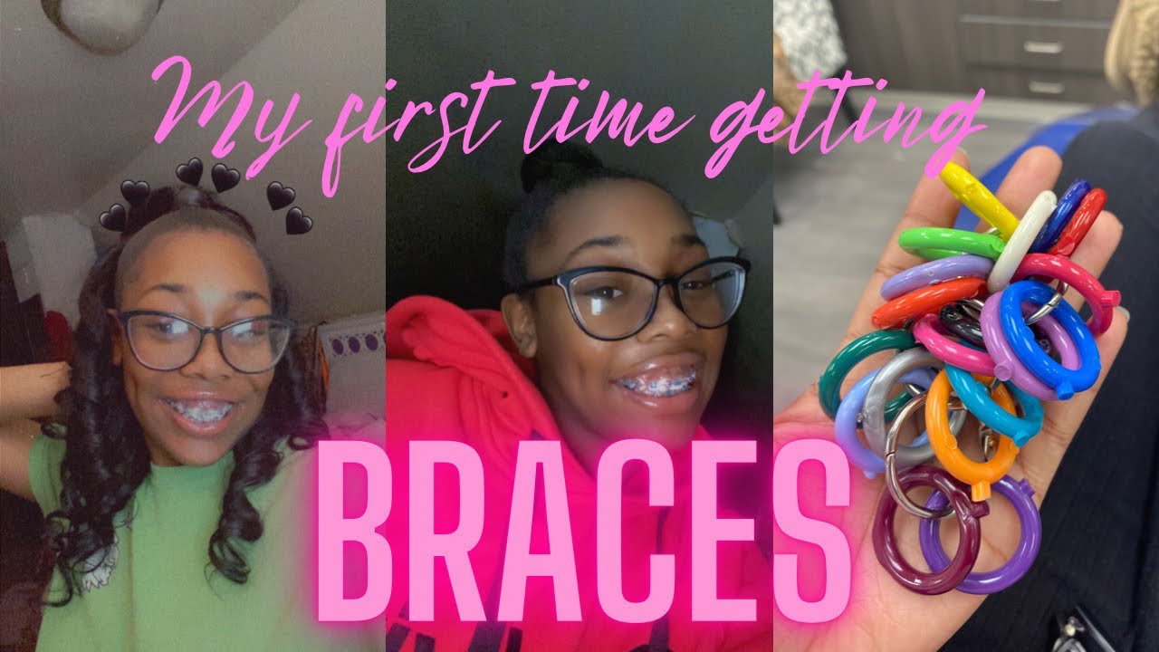 VLOG: My first time getting braces