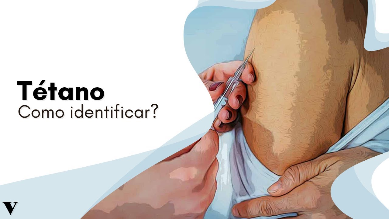 Como Identificar e se Previnir do T&eacute;tano