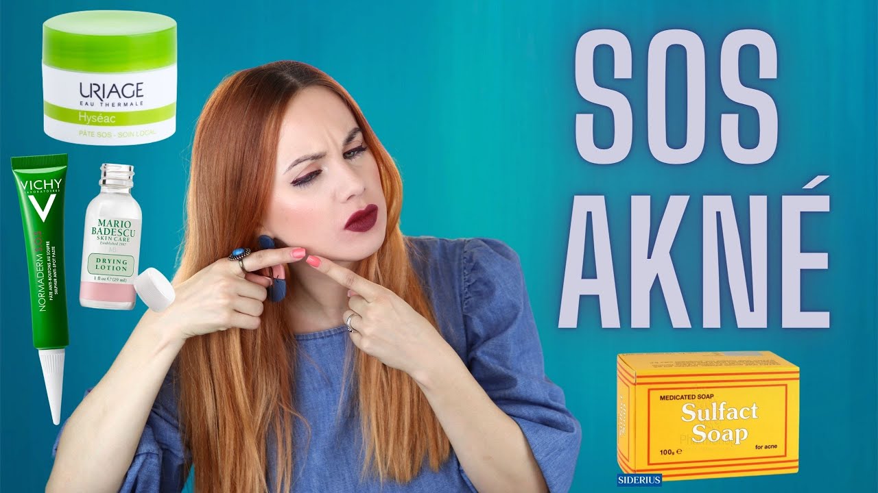 SOS Akné