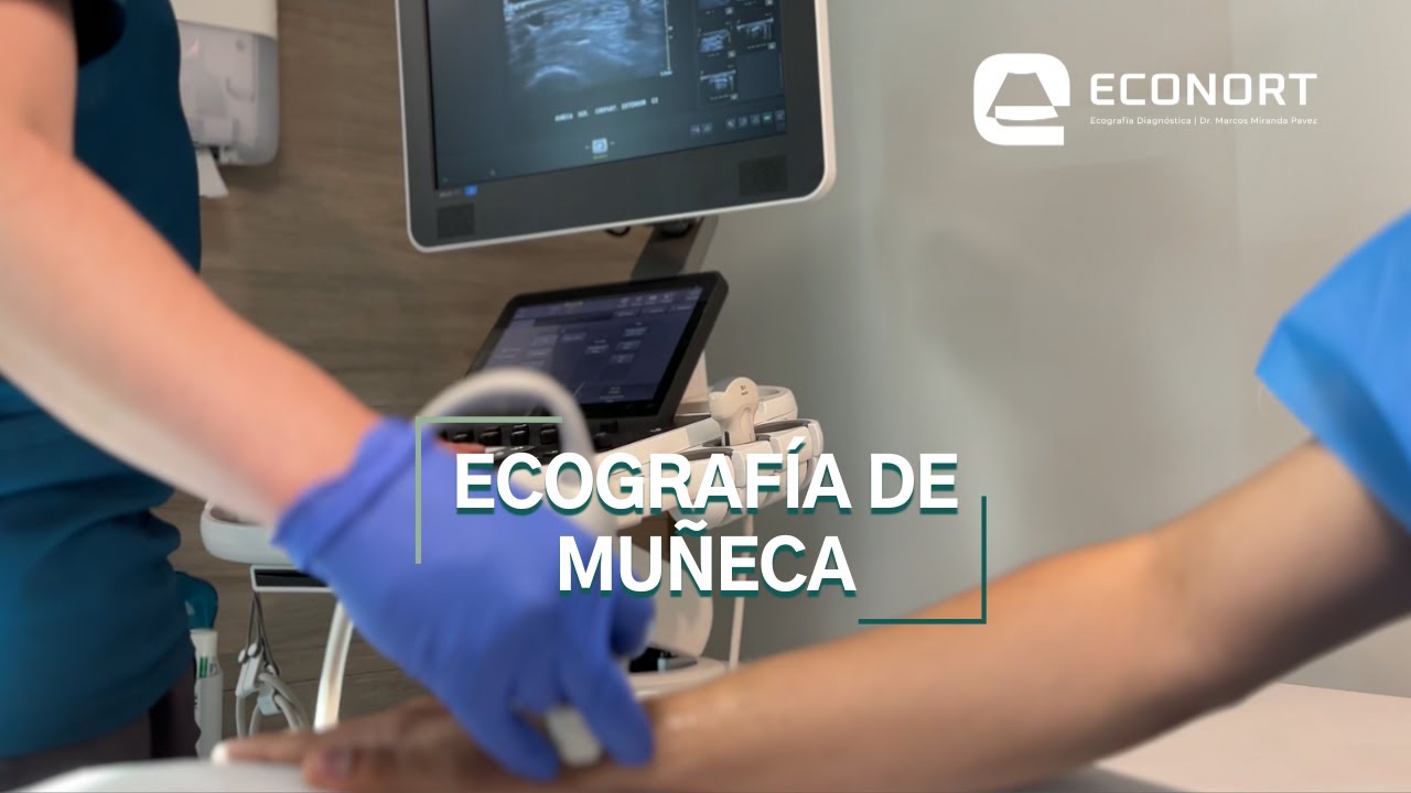 Ecografía de Muñeca Antofagasta - ECONORT