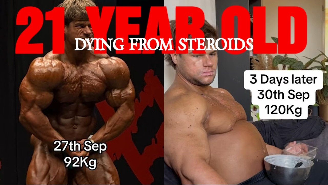 21 On Steroids And Going To Die