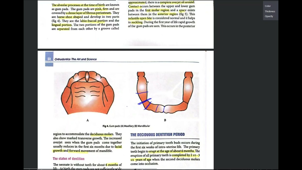 Demo class: Orthodontics