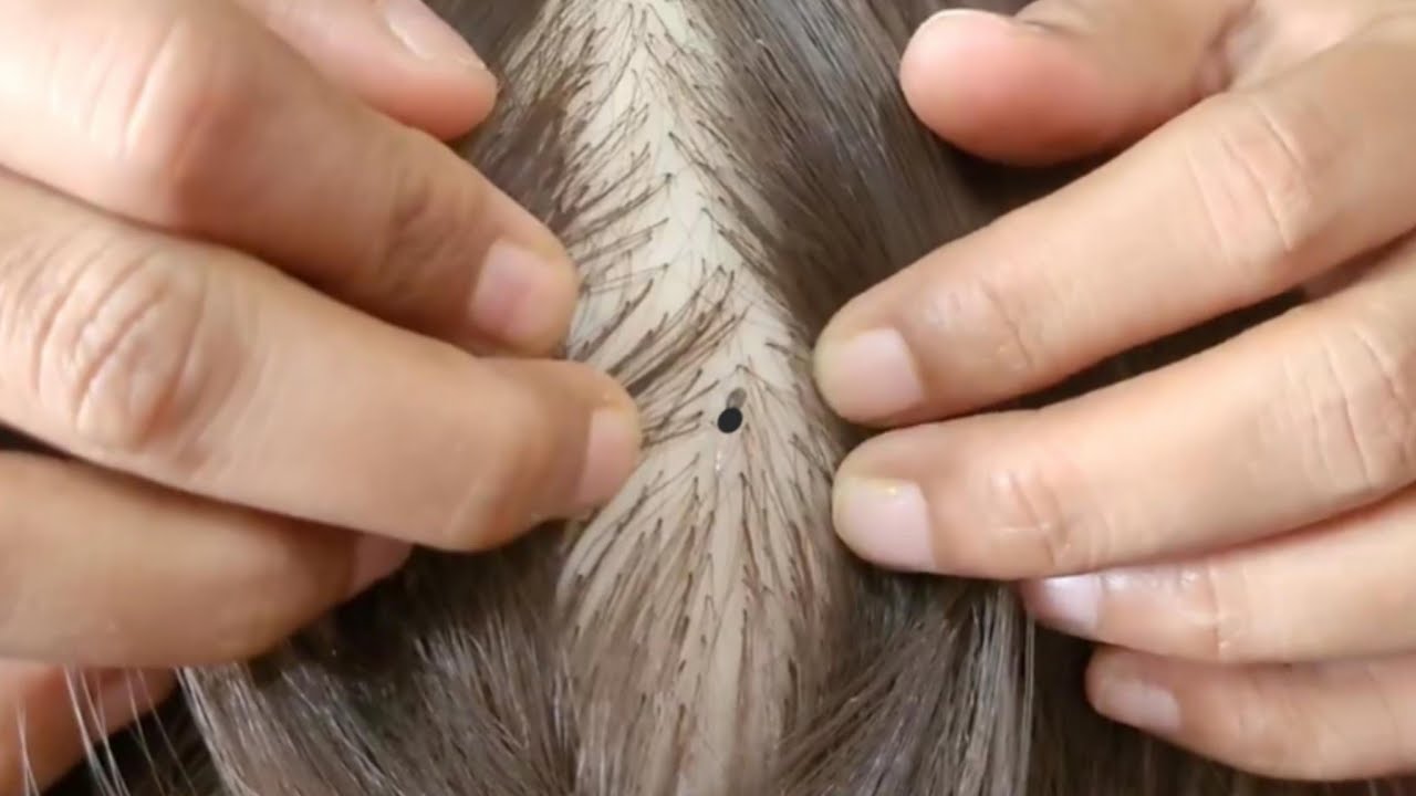 🌛ASMR - lice Check & Scalp Check Extremely Satisfying, Scratching and Good Sleep 😴 #asmr #tingles