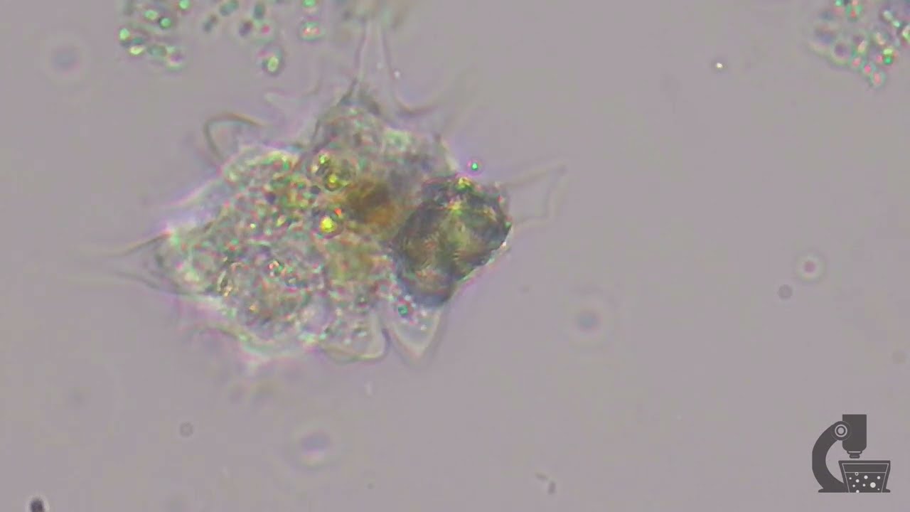 An Ameboid Introduction to Animalcules