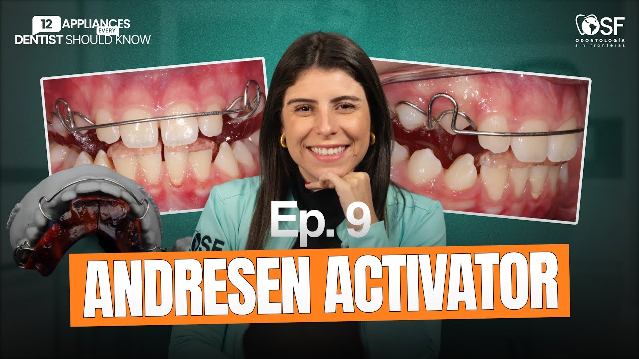 EP.9: Andressen Activator | The Most Underrated Appliance in Orthodontics?