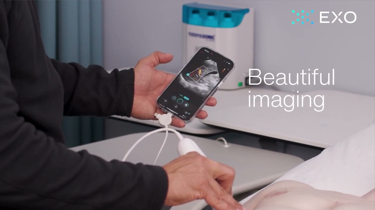 Handheld Ultrasound with 150&deg; View and Clear Imaging | Exo Iris&trade;