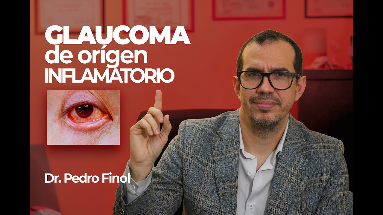 Glaucoma inflamatorio: señales de alerta y tratamiento