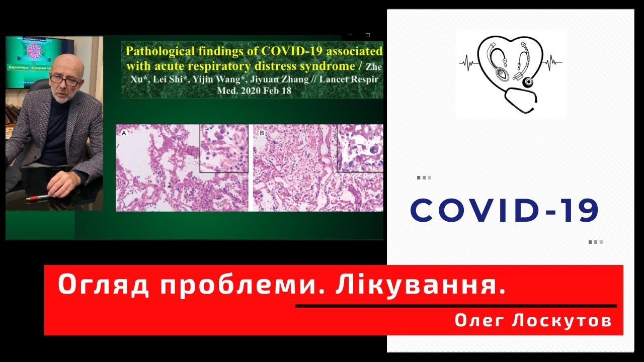 COVID-19. Огляд проблеми. Лікування
